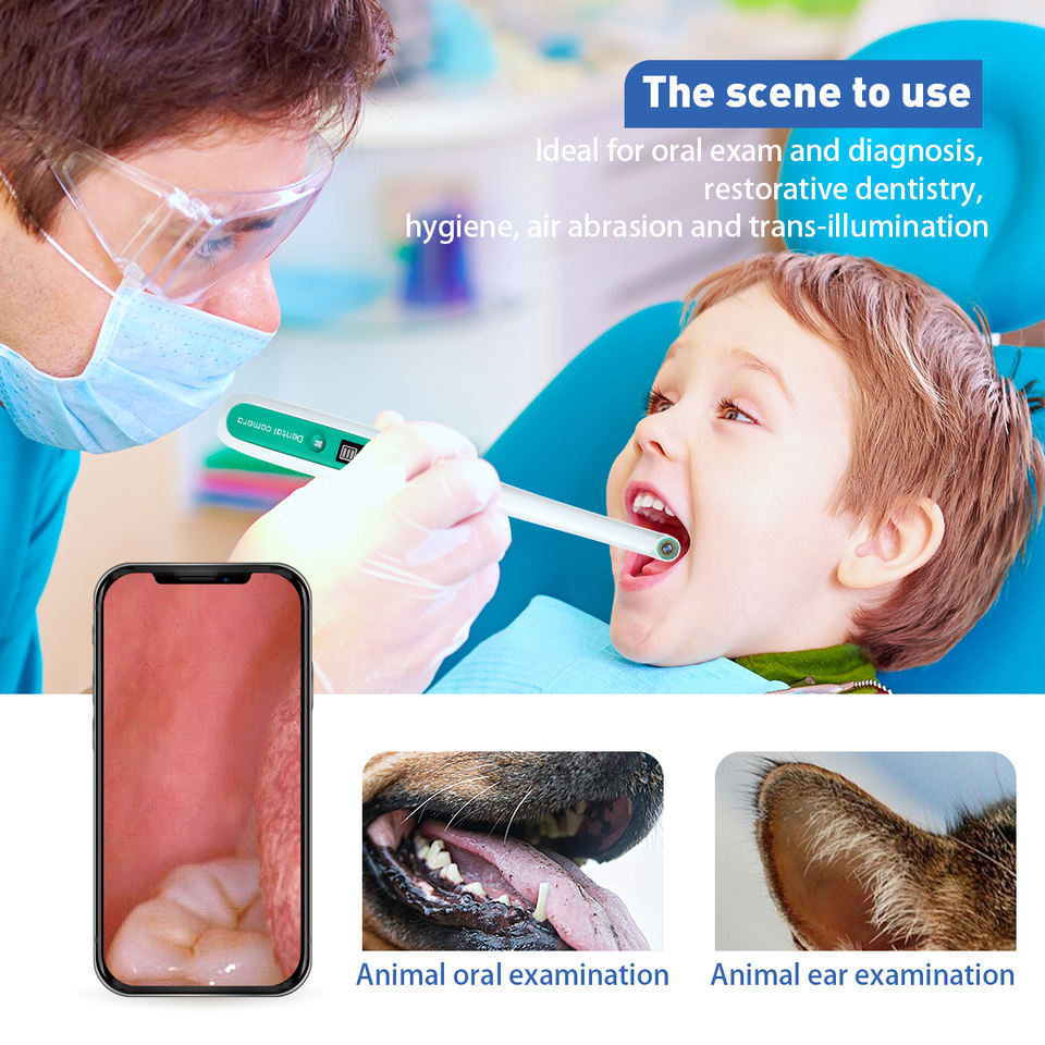 Wireless Wifi Visual Endoscopy - مراجعة Lighting Visual وسعره
